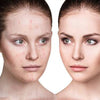 Shop Blemishes & Spots