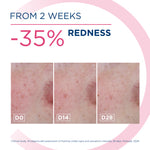 BIODERMA SENSIBIO AR+ CREAM 40ML