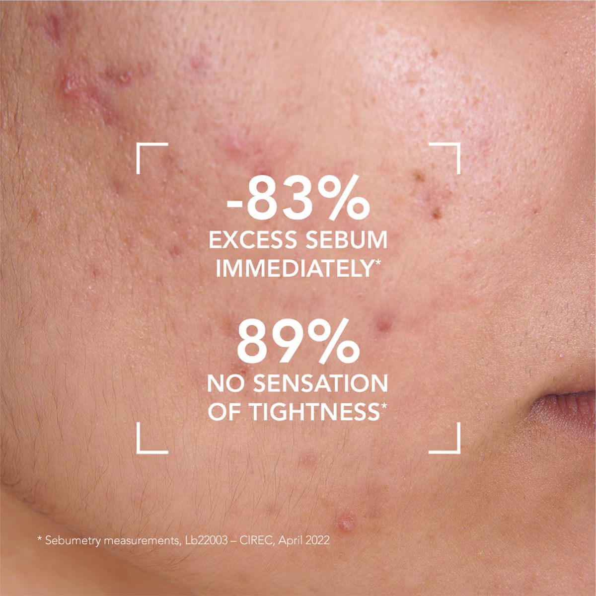 Bioderma Sebium Foaming Gel Pump 200ml