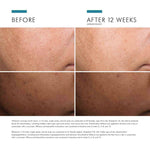 Skinceuticals Discoloration Defense Serum 30ml