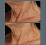 dermalogica neck fit contour serum