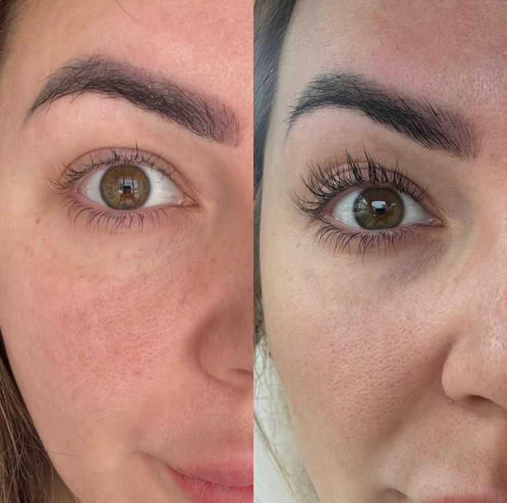 Obagi Nu-Cil Lashes and Brows Value Kit