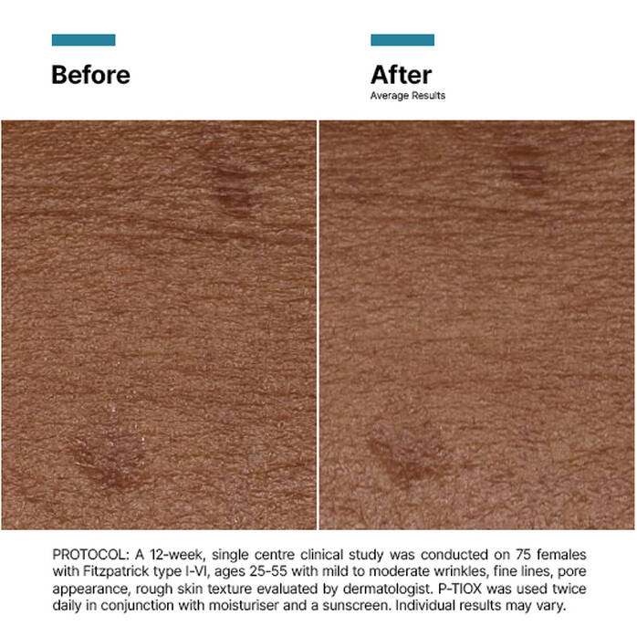 SkinCeuticals P-Tiox Neuro-Peptide Serum 30ml