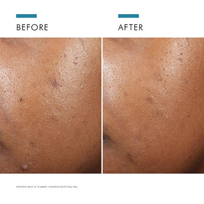 Skinceuticals Phyto A+ Brightening Moisturiser 30ml