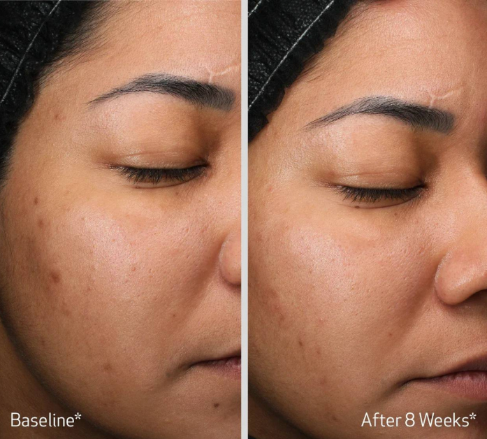 OBAGI Retinol + PHA Refining Night Cream 50ml