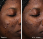 OBAGI Retinol + PHA Refining Night Cream 50ml