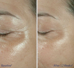 OBAGI ELASTIderm Eye Cream 15g