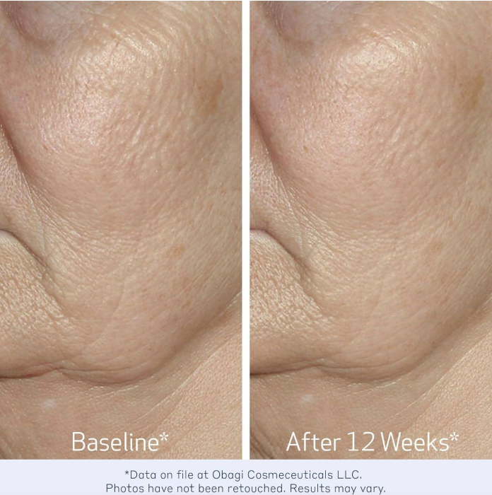 OBAGI ELASTIderm Facial Serum 30ml