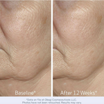 OBAGI ELASTIderm Facial Serum 30ml