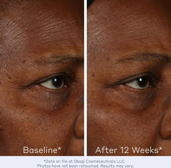 OBAGI ELASTIderm Facial Serum 30ml