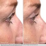 OBAGI Nu-Cil Eyelash Enhancing Serum 3ml