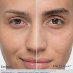 OBAGI Nu-Cil Eyebrow Boosting Serum 5ml