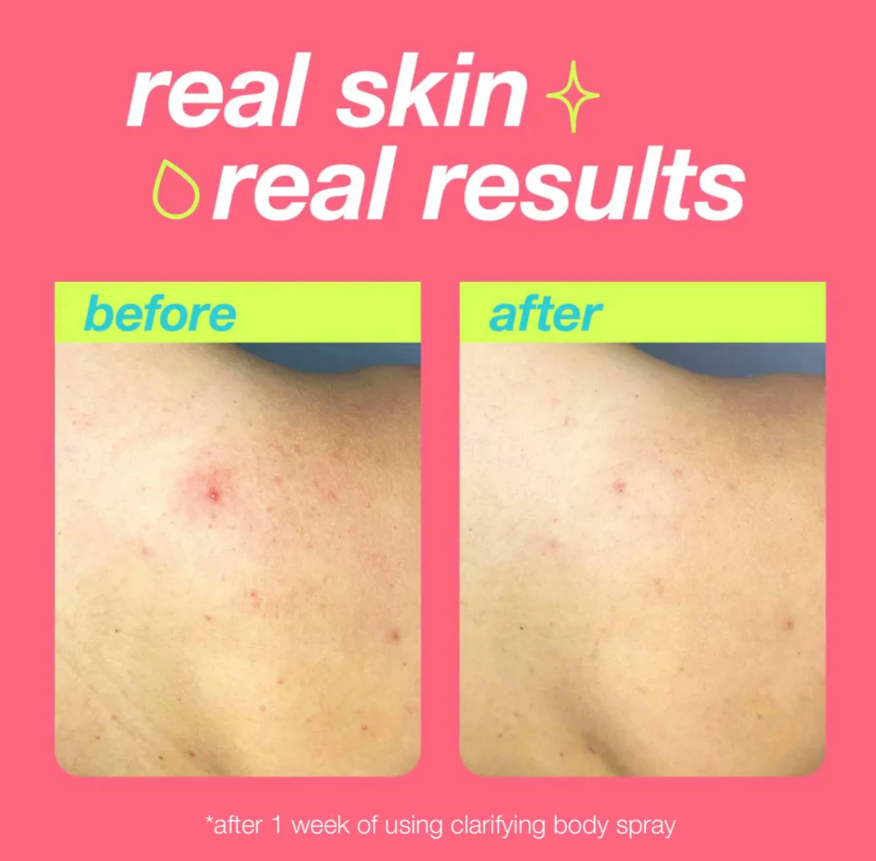 Dermalogica Clear Start Clarifying Body Spray