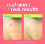 Dermalogica Clear Start Clarifying Body Spray