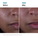 SkinCeuticals Double Defence Silymarin and Oil Shield UV Kit (Worth £221)