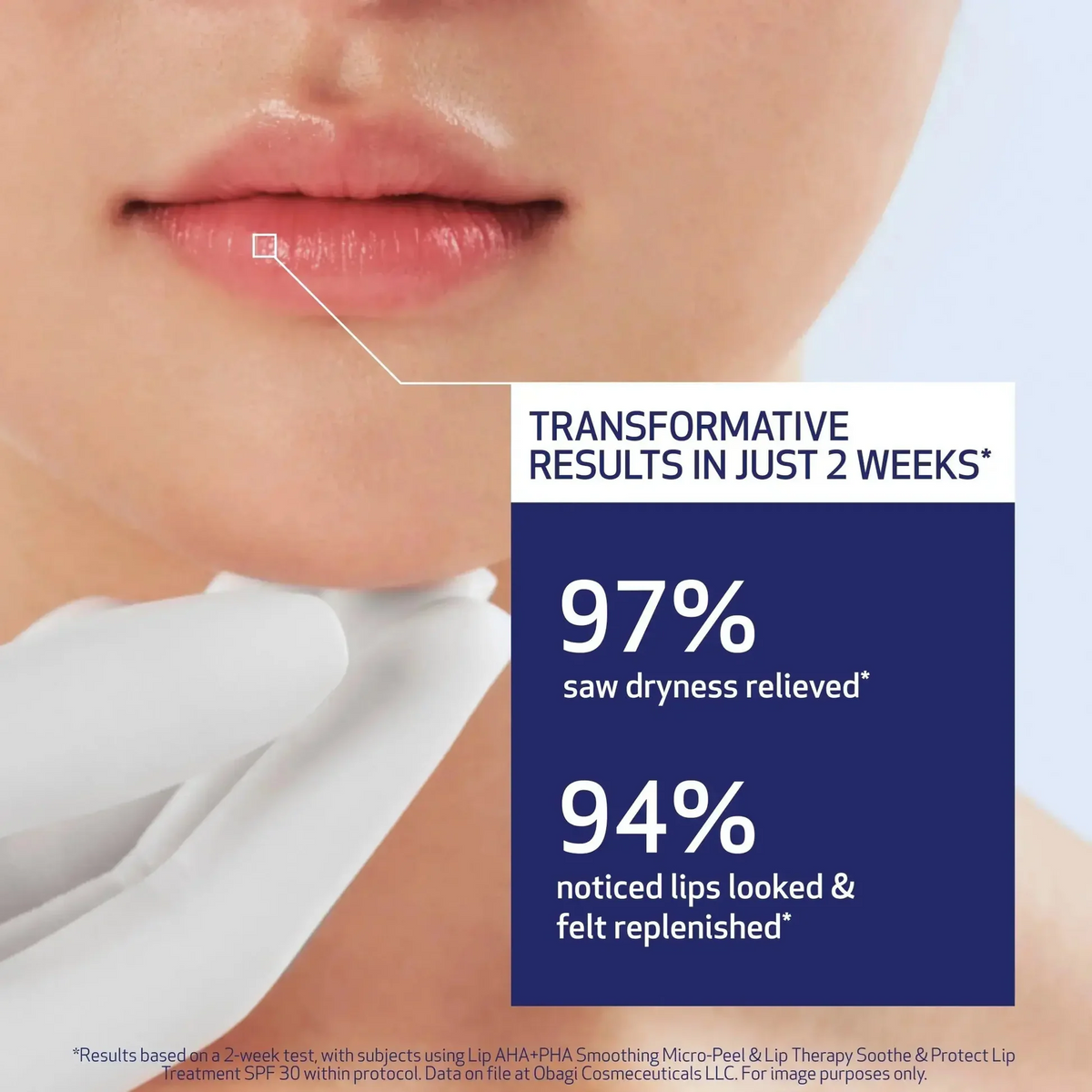 Obagi Soothe and Protect Lip Treatment SPF 30 10ml