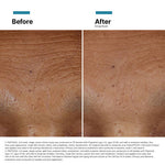Plumping & Anti-Ageing Power Pair