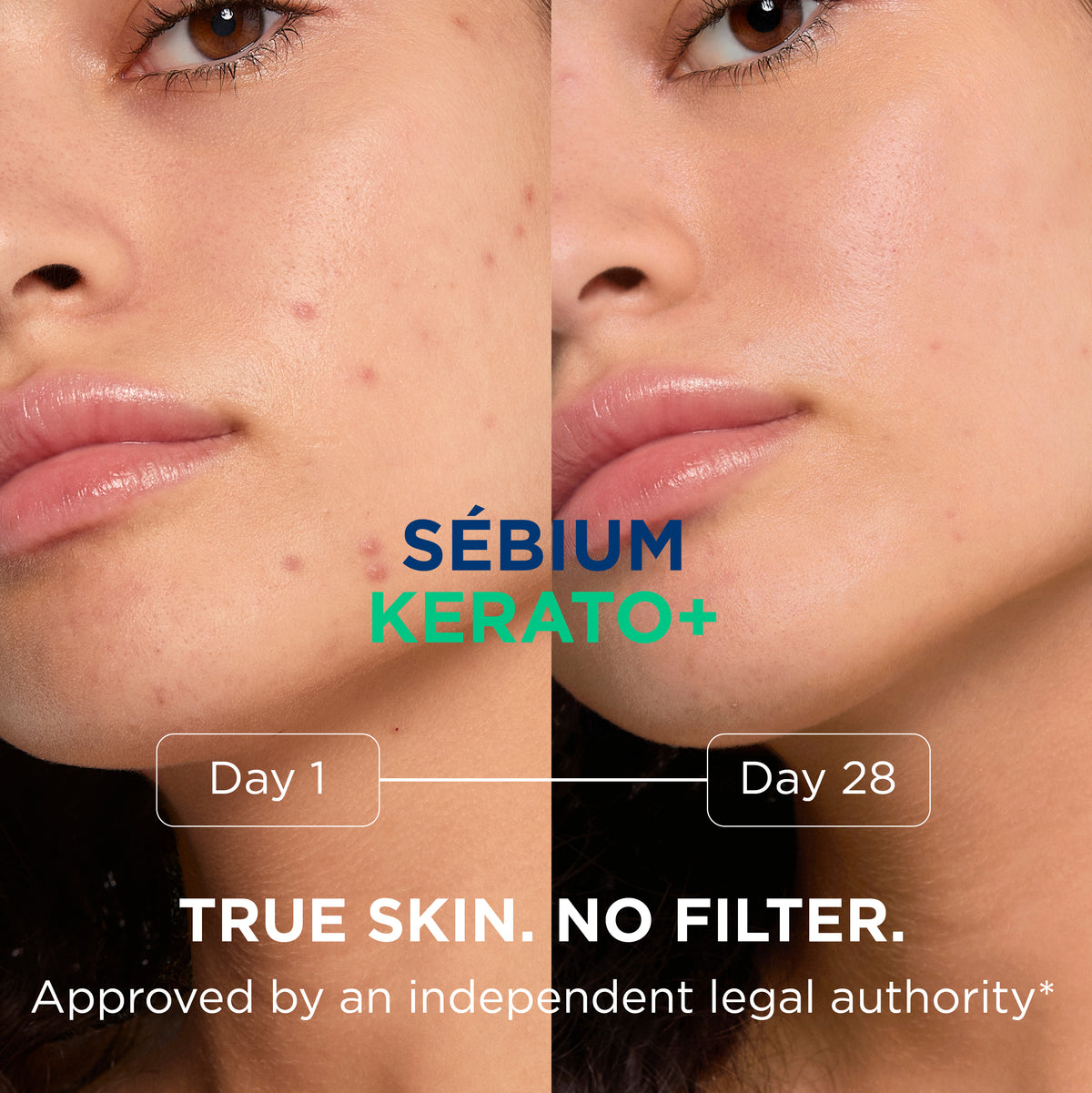 BIODERMA SEBIUM KERATO+ 30ML