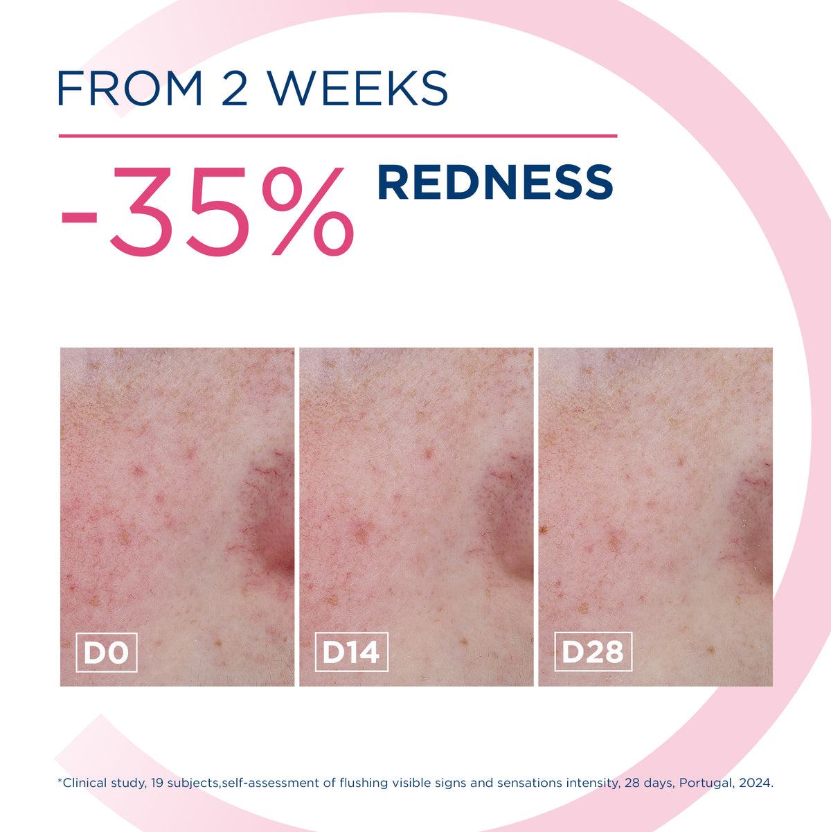 BIODERMA SENSIBIO AR+ CREAM 40ML