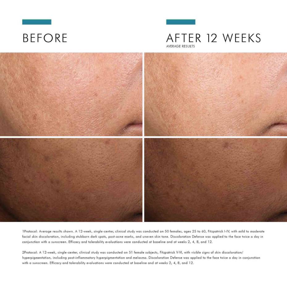 Skinceuticals Discoloration Defense Serum 30ml