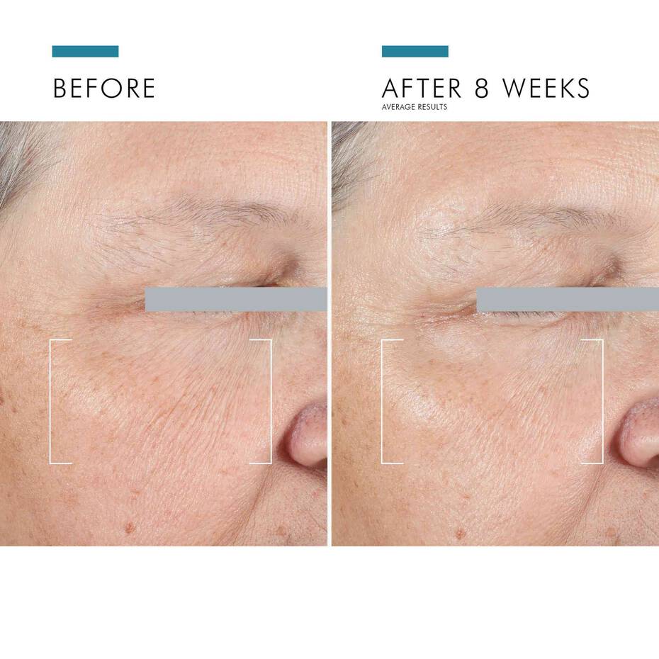Skinceuticals A.G.E Advanced Eye 15ml