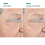 Skinceuticals A.G.E Advanced Eye 15ml
