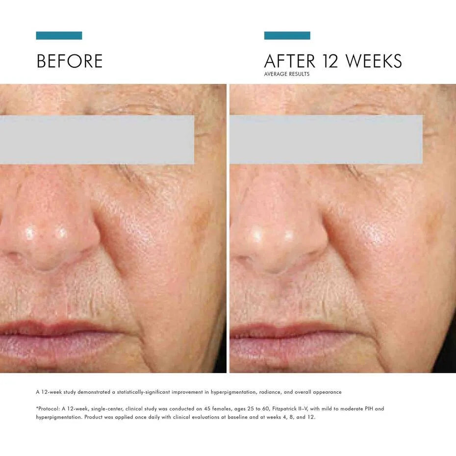 Skinceuticals Brightening Uv Defense Spf30 30ml