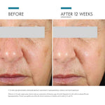 Skinceuticals Brightening Uv Defense Spf30 30ml