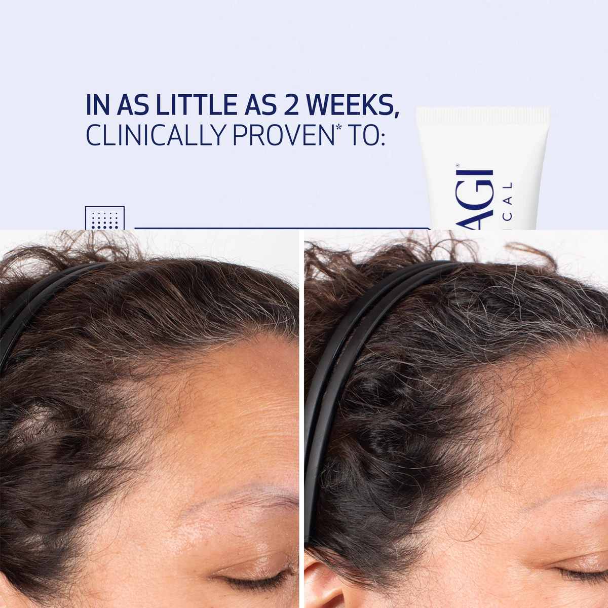 OBAGI Nu-Cil Biostim Scalp Serum 60ml