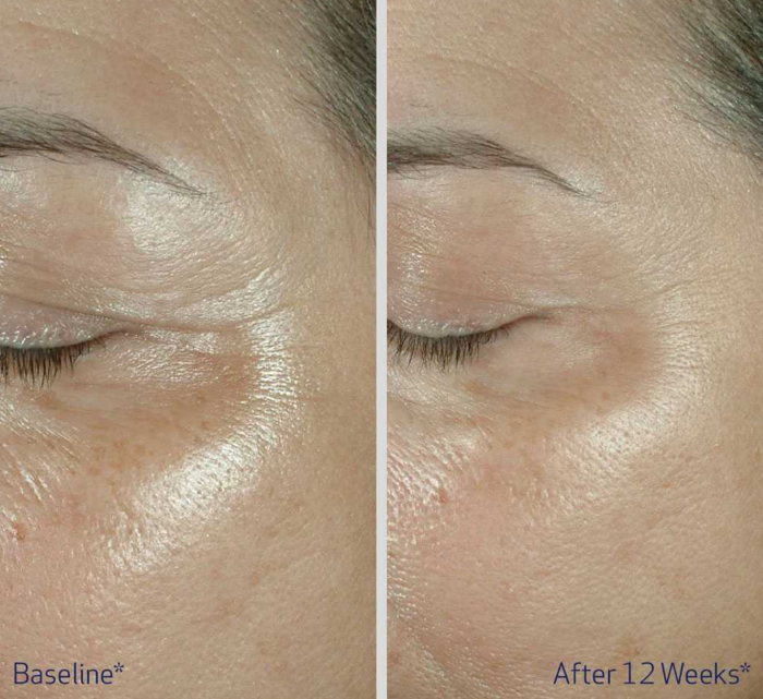 OBAGI ELASTIderm Eye Cream