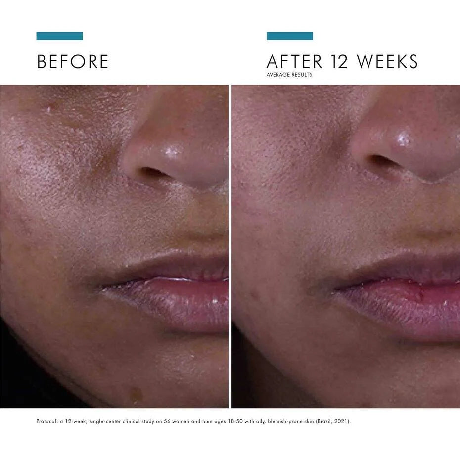 Skinceuticals Silymarin Aox 30ml