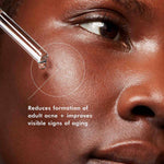 Skinceuticals Blemish + Age Defense 30ml