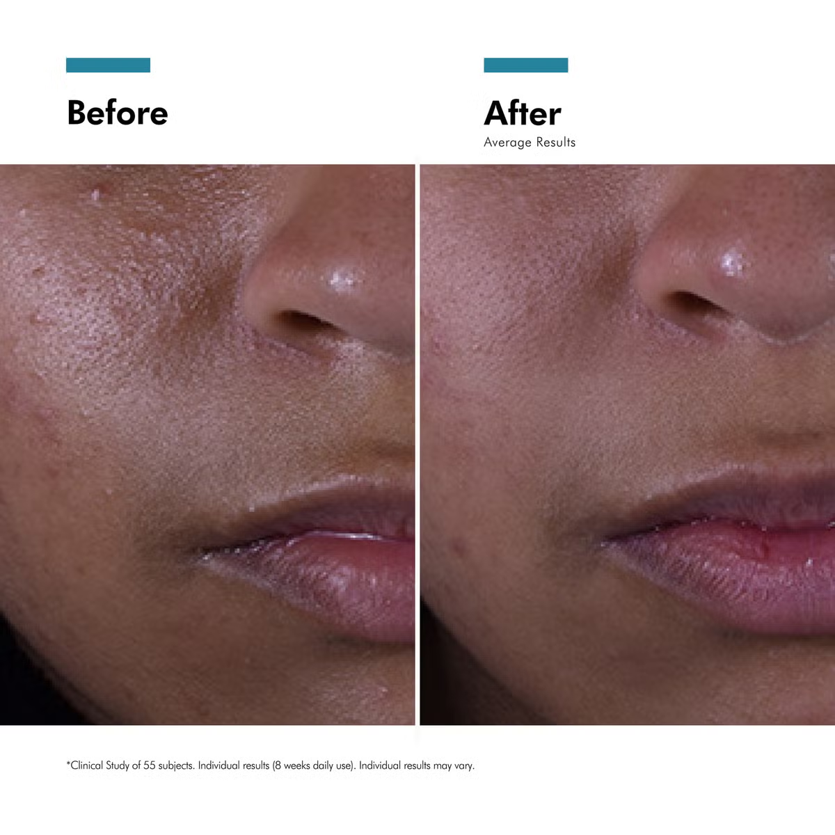 SkinCeuticals Double Defence Silymarin and Oil Shield UV Kit (Worth £221)