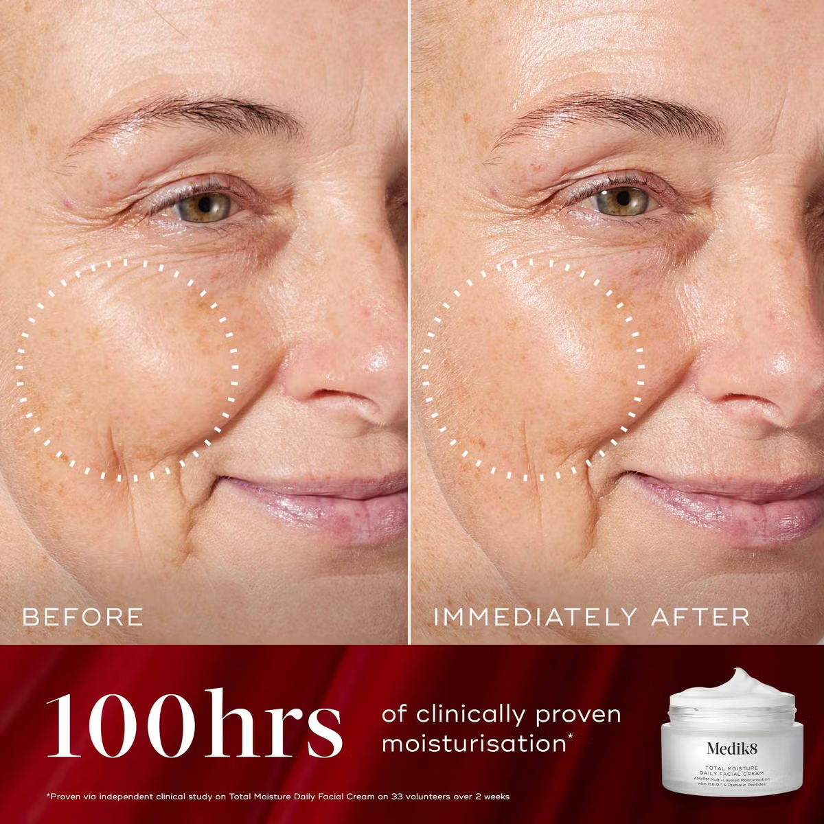 Medik8 Radiance Wrapped Gift Set (Worth £90)