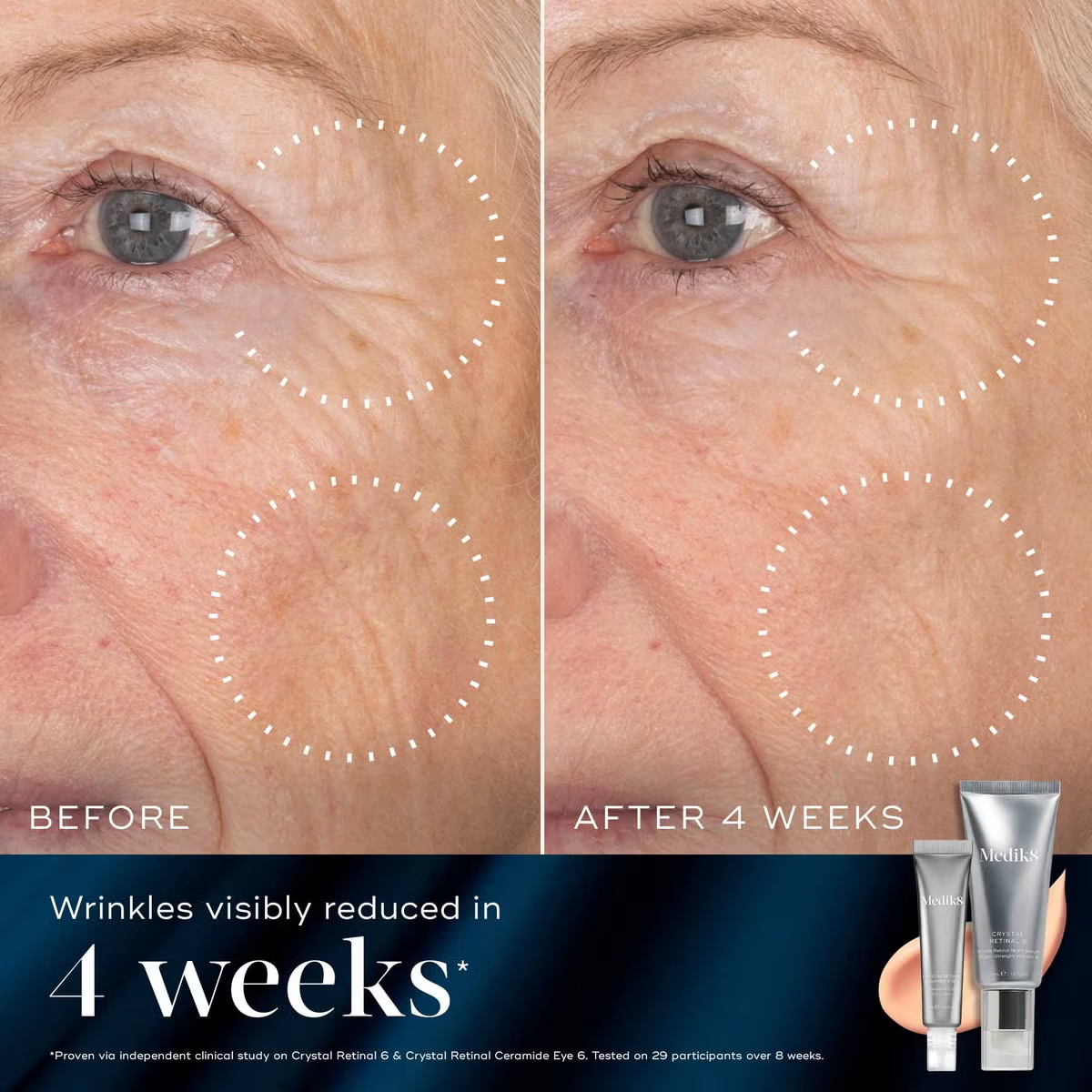 Medik8 Retinal Rewind Gift Set (Worth £91)