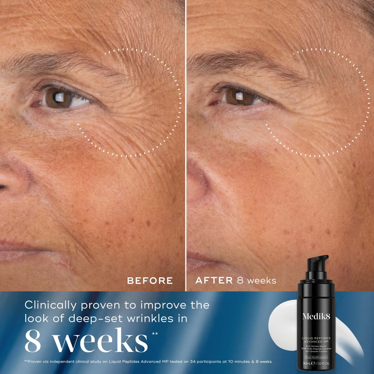 Medik8 Rejuvination Reset Gift Set (Worth £109)