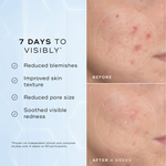 Medik8 Niacinamide Peptides 30ml